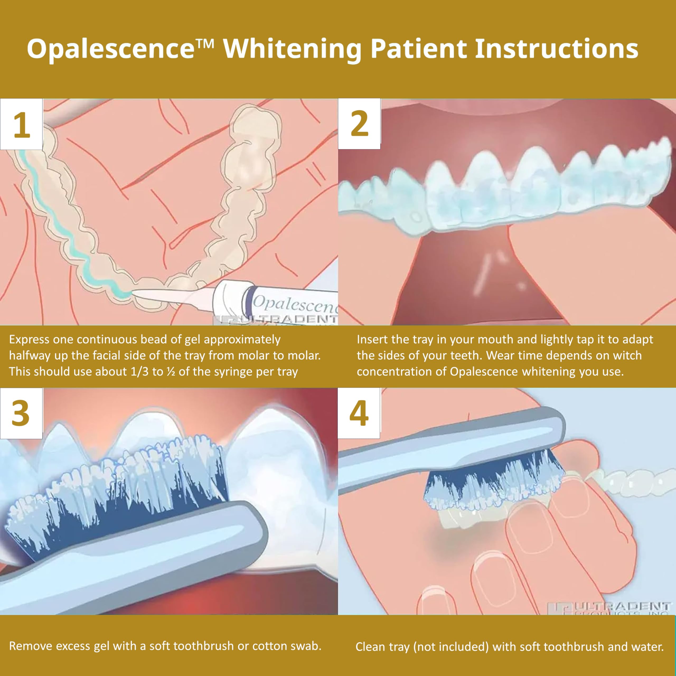 Opalescence fabrique aux etats-unis Ultradent: fabriqué aux États-Unis par Ultradent.