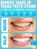 Bandes Oralfree agissent en 30 minutes pour des résultats progressifs