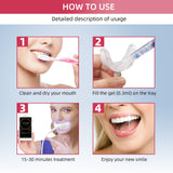 Sourire brillant compatible avec couronnes et facettes, grâce à Pdoo.