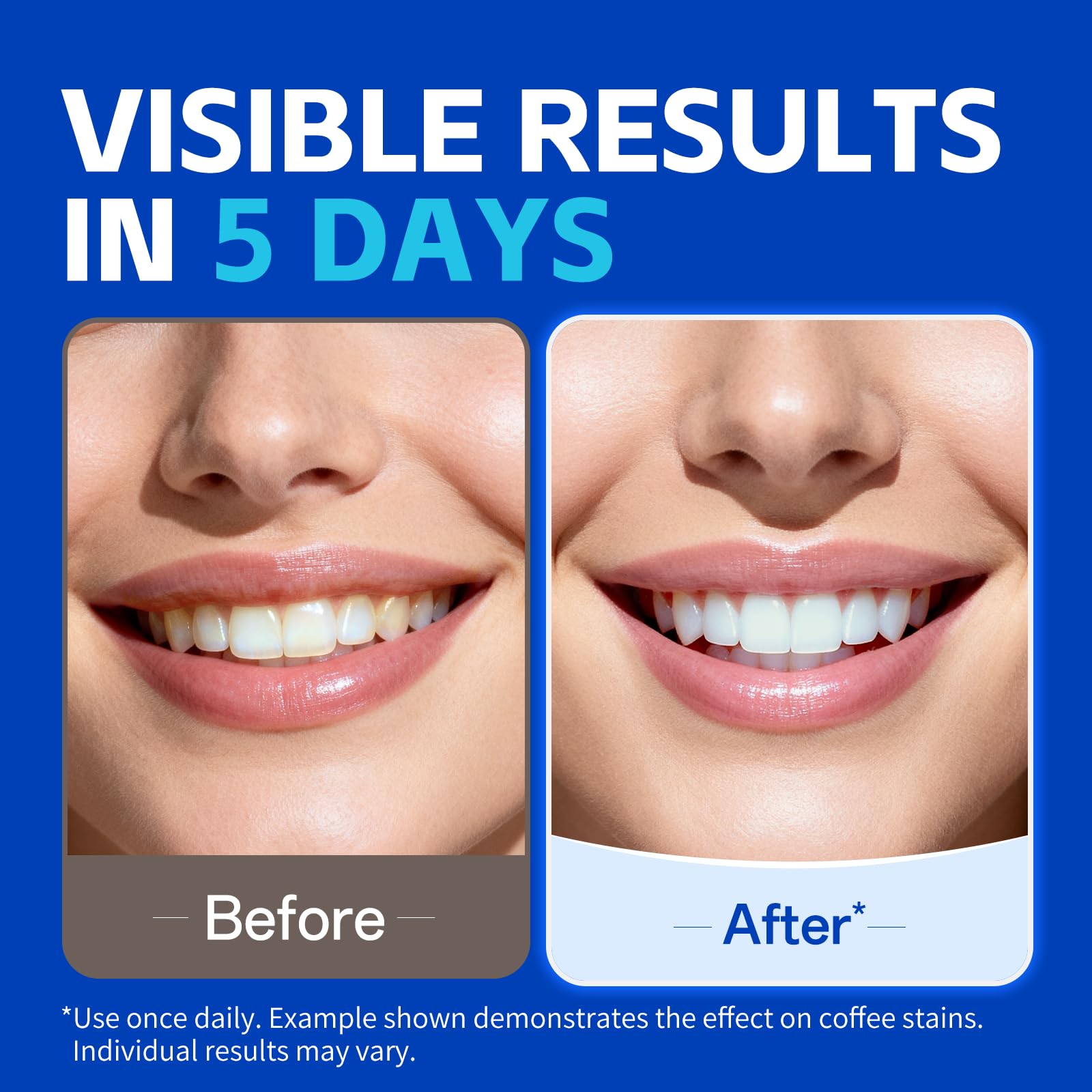 PERSMAX – bandes de blanchiment rapides, effet visible en 30 minutes.