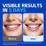 PERSMAX – bandes de blanchiment rapides, effet visible en 30 minutes.