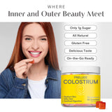Immunoglobulines présentes, soutien immunitaire potentiel avec Prelude Colostrum