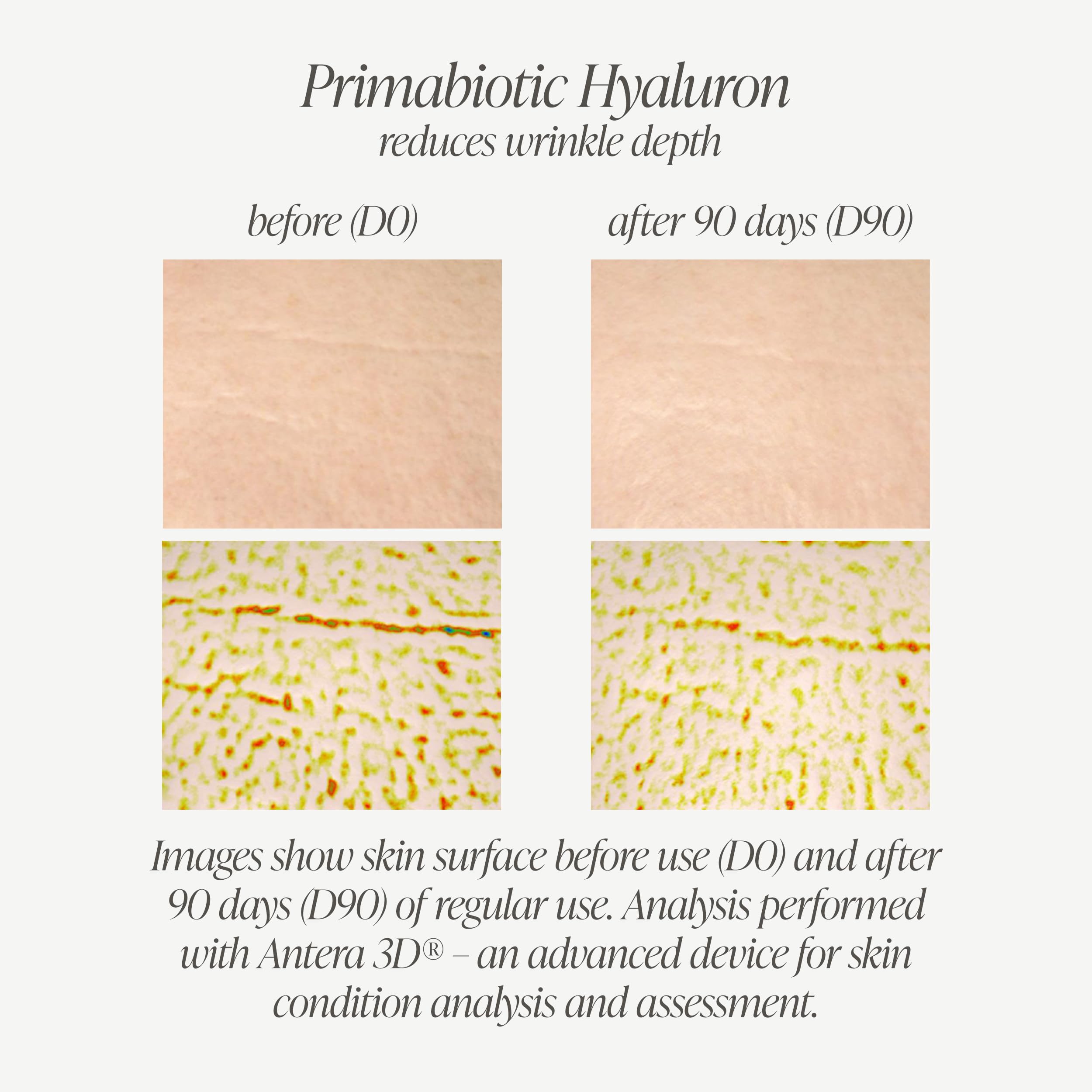 PRIMABIOTIC Hyaluronique 250 mg mangue – étiquette ingrédients pour transparence.