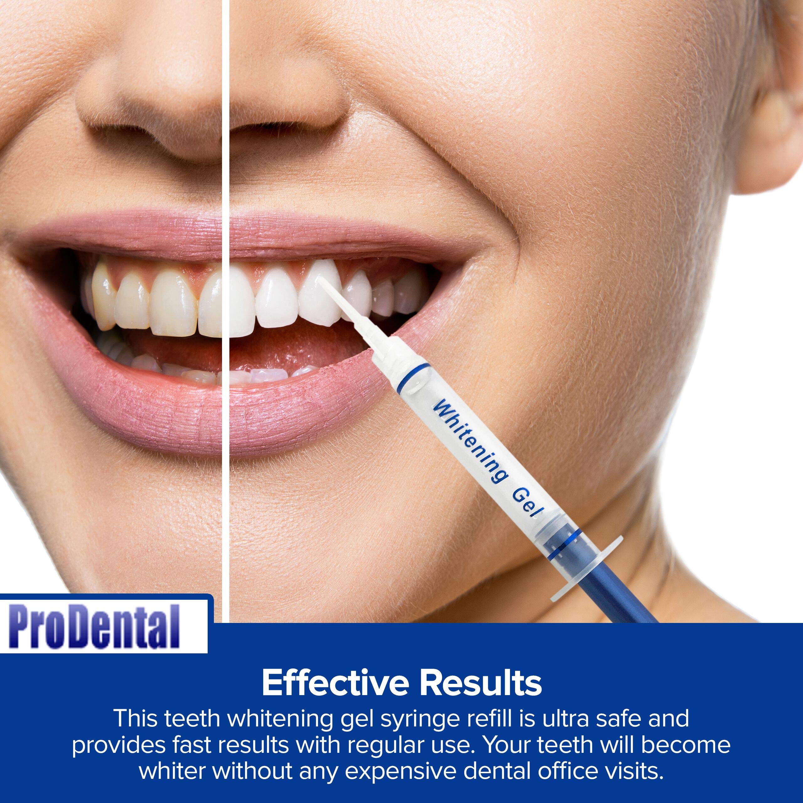 ProDental gel visqueux permet une application propre et contrôlée.