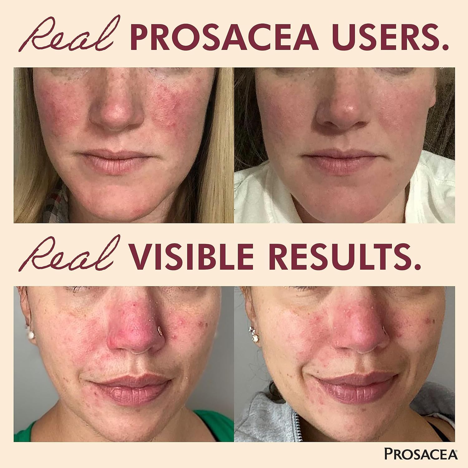Prosacea gel absorption rapide, texture légère idéale sous maquillage