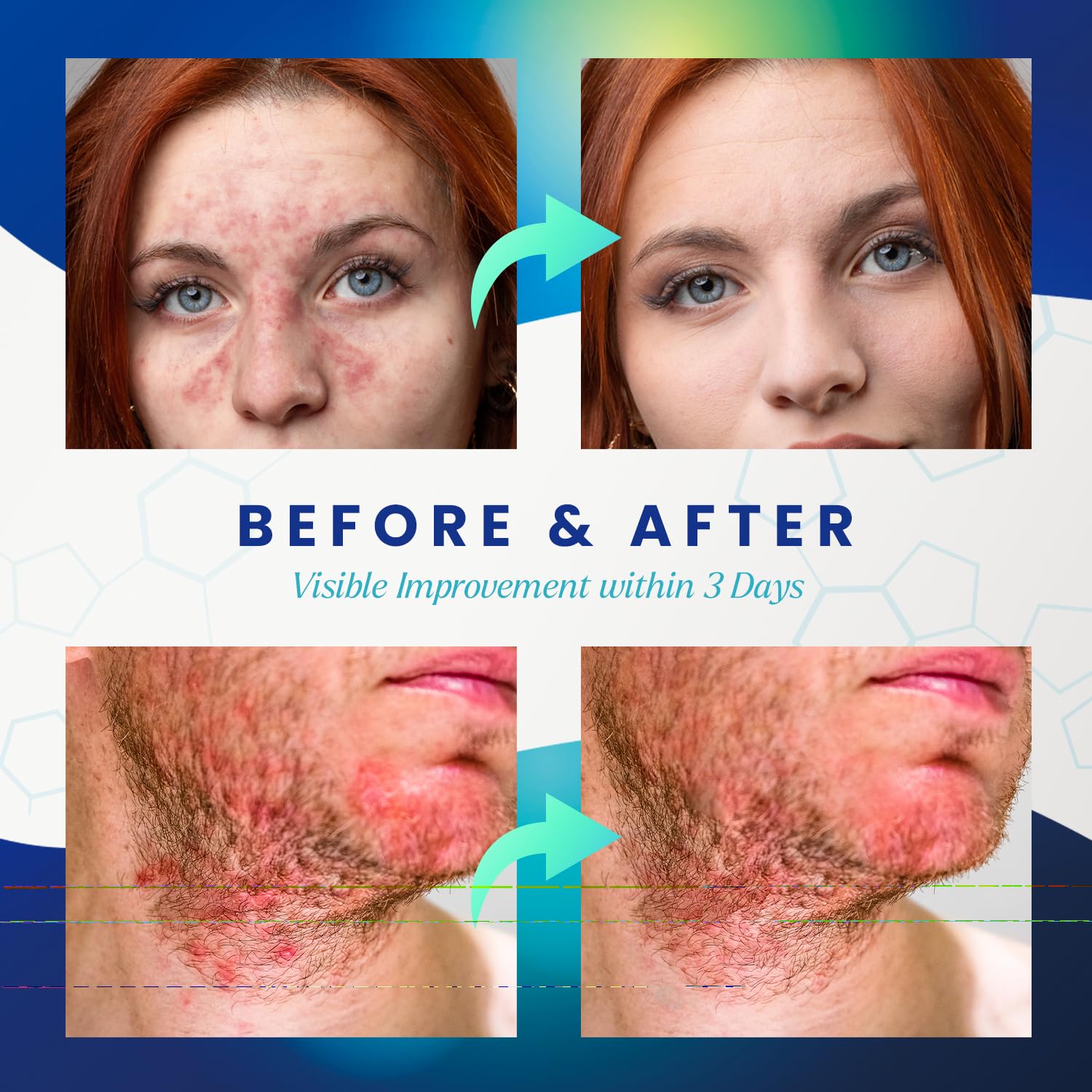 PURESKIN texture crème onctueuse avec absorption rapide.