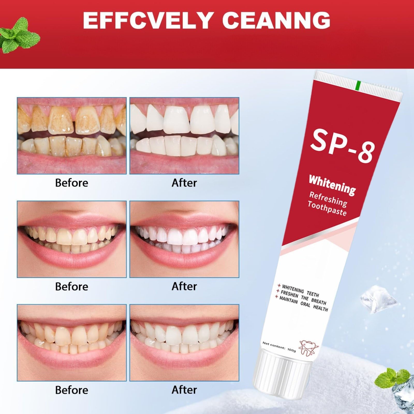 Nettoyage en profondeur des surfaces dentaires avec SP-8 Probiotique.