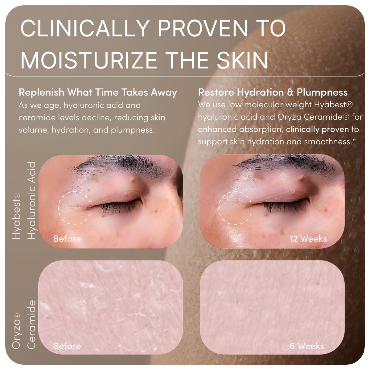 Ready To GLOW phytoceramides d'origine riz : meilleure rétention d'humidité.