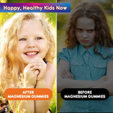 Gommes Revianutra Calm – gommes faciles à mâcher et plaisantes à consommer.