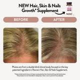 REVIVEEO capsules, soutiennent cheveux et ongles forts