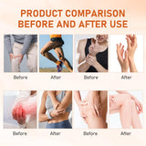Rooroopet Emu Oil Turmeric Gel : sensation fraîche non irritante