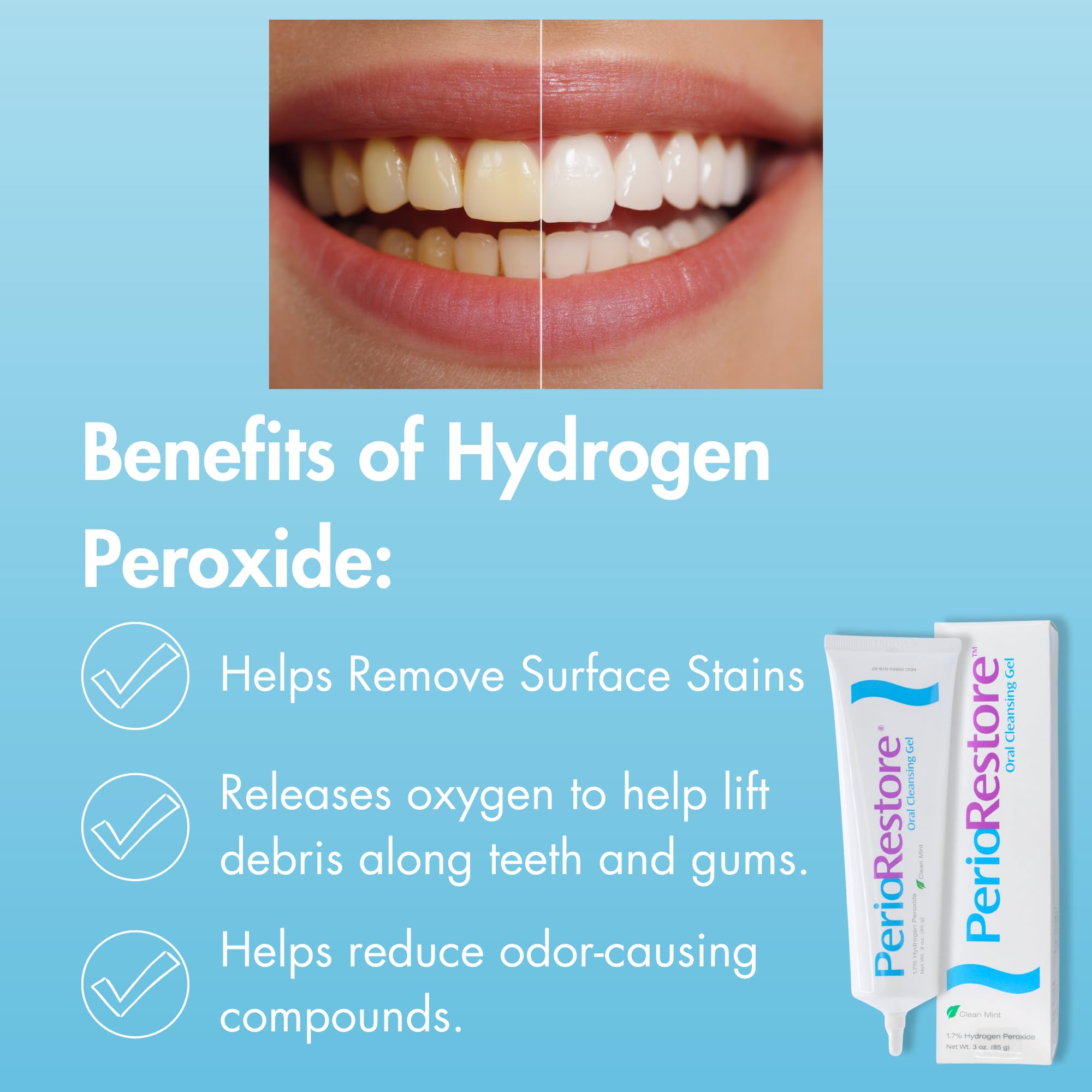 ROTADENT PROCARE Blanchiment progressif des dents possible sans compromis.