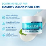 Roycederm Rosacée – application crème: apaise les irritations.