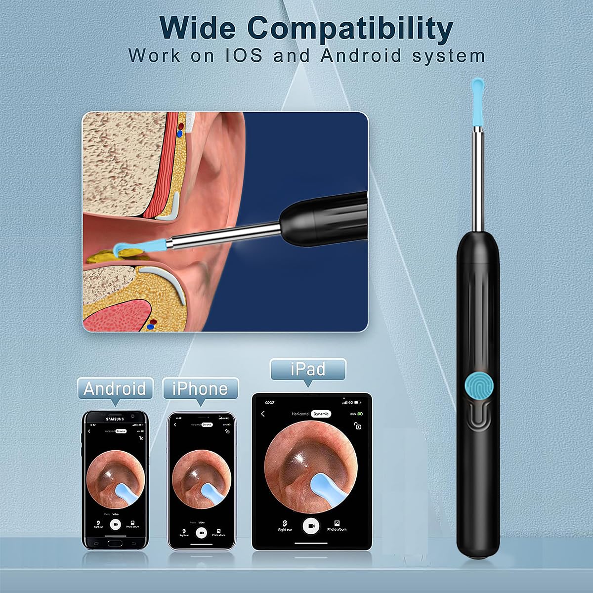 RSRNKXC 6 sondes d'oreille pour un ensemble complet.