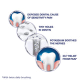 Sensodyne gencives-saines: image d'une bouche avec gencives visiblement saines.