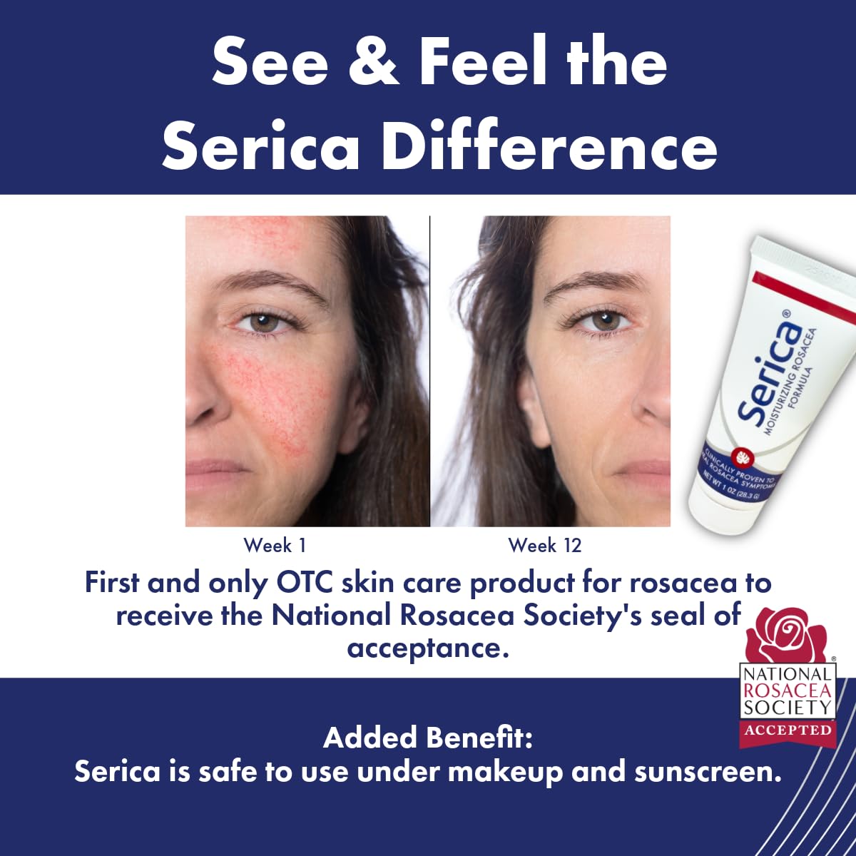 Utilisation quotidienne de la Crème Rosacée Sericae pour apaiser et lisser
