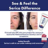 Utilisation quotidienne de la Crème Rosacée Sericae pour apaiser et lisser