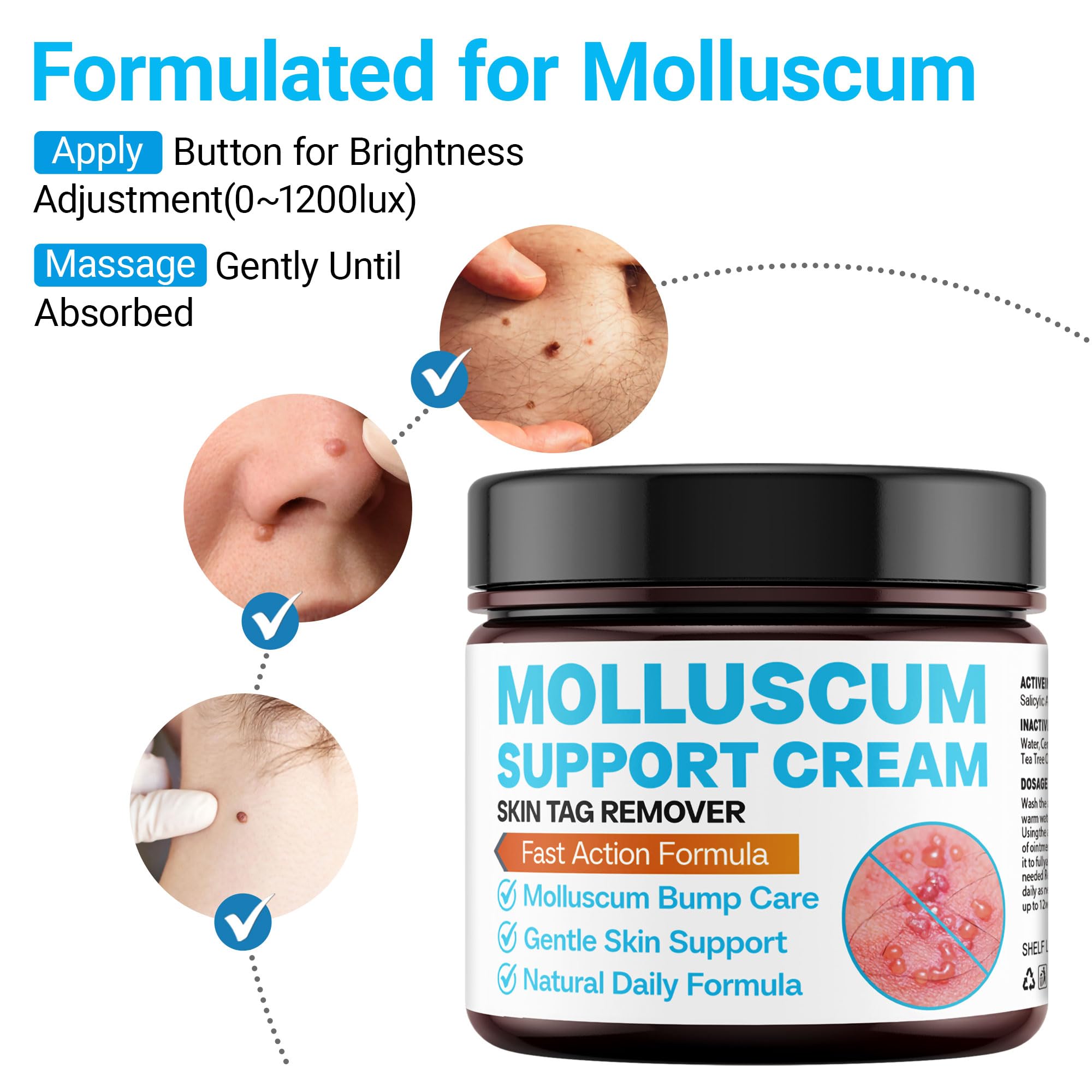 SHUNNIUB Molluscum Soutien crème-application, facile à appliquer 2-3 fois par jour.