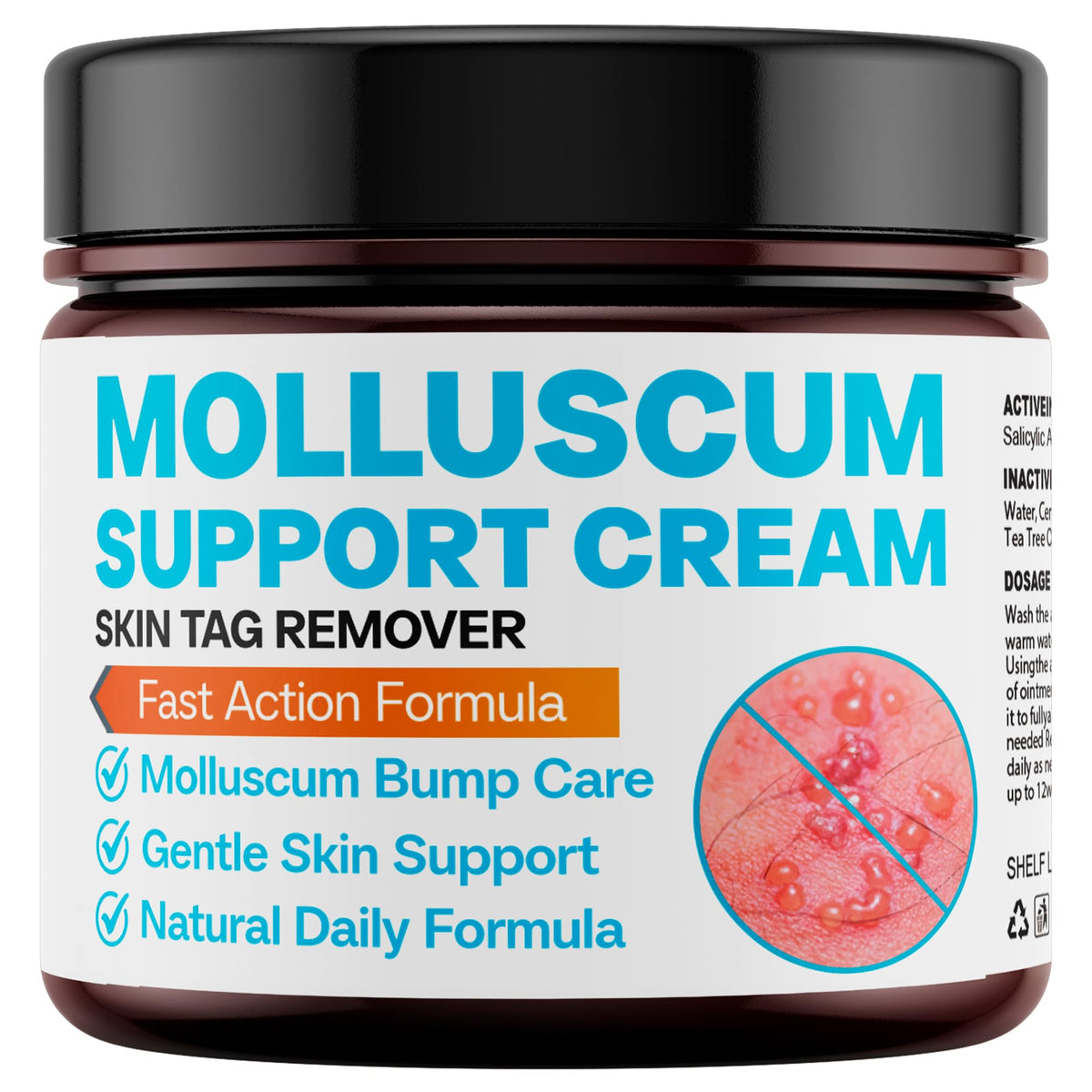 SHUNNIUB Molluscum Soutien crème-bouteille, soin doux pour peau sensible et utilisation quotidienne.