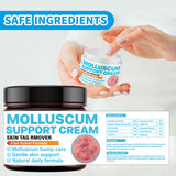SHUNNIUB Molluscum Soutien peau-relief, soutien en douceur pour les zones affectées.
