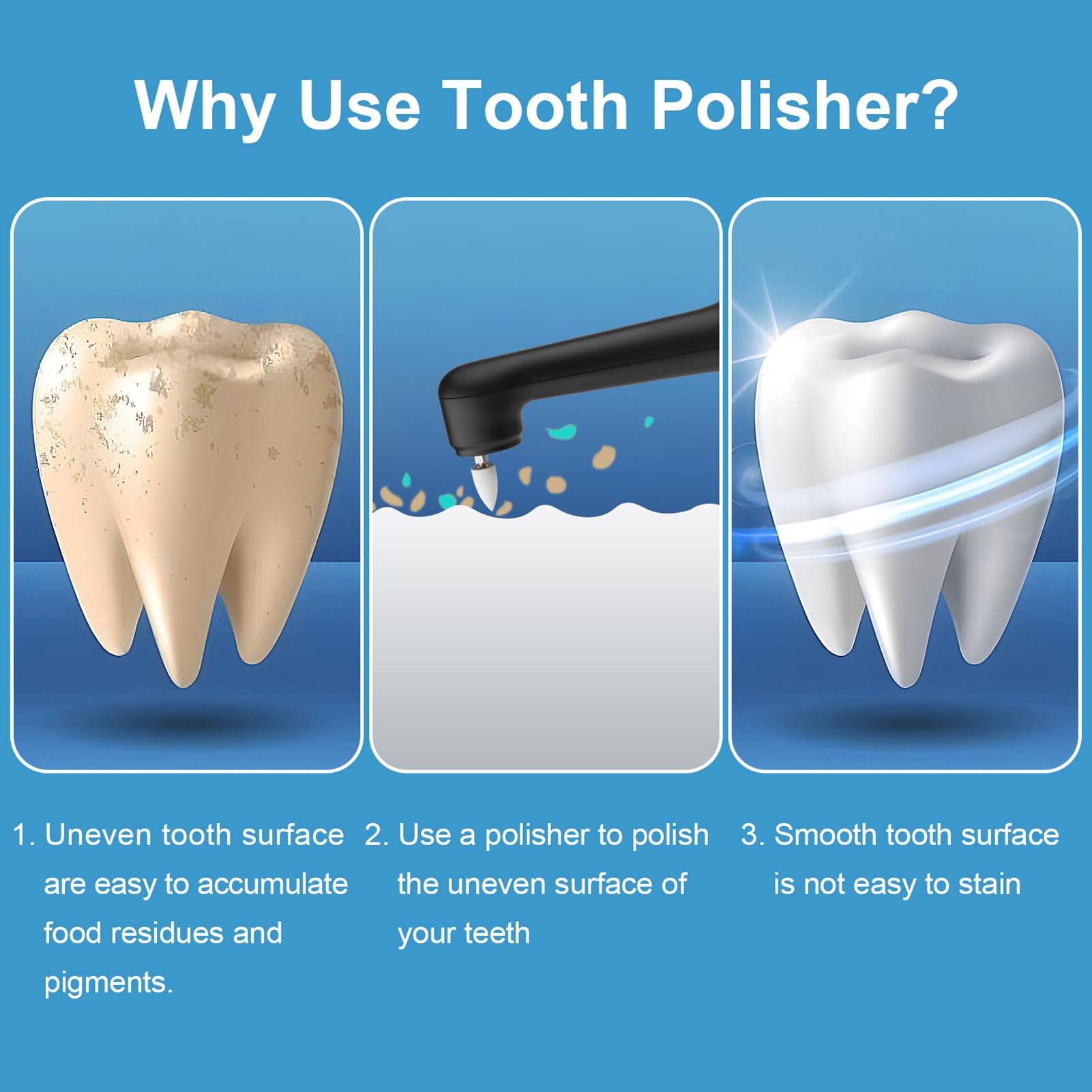 SIQUER polisseur dents avec brosse flat top pour résidus.
