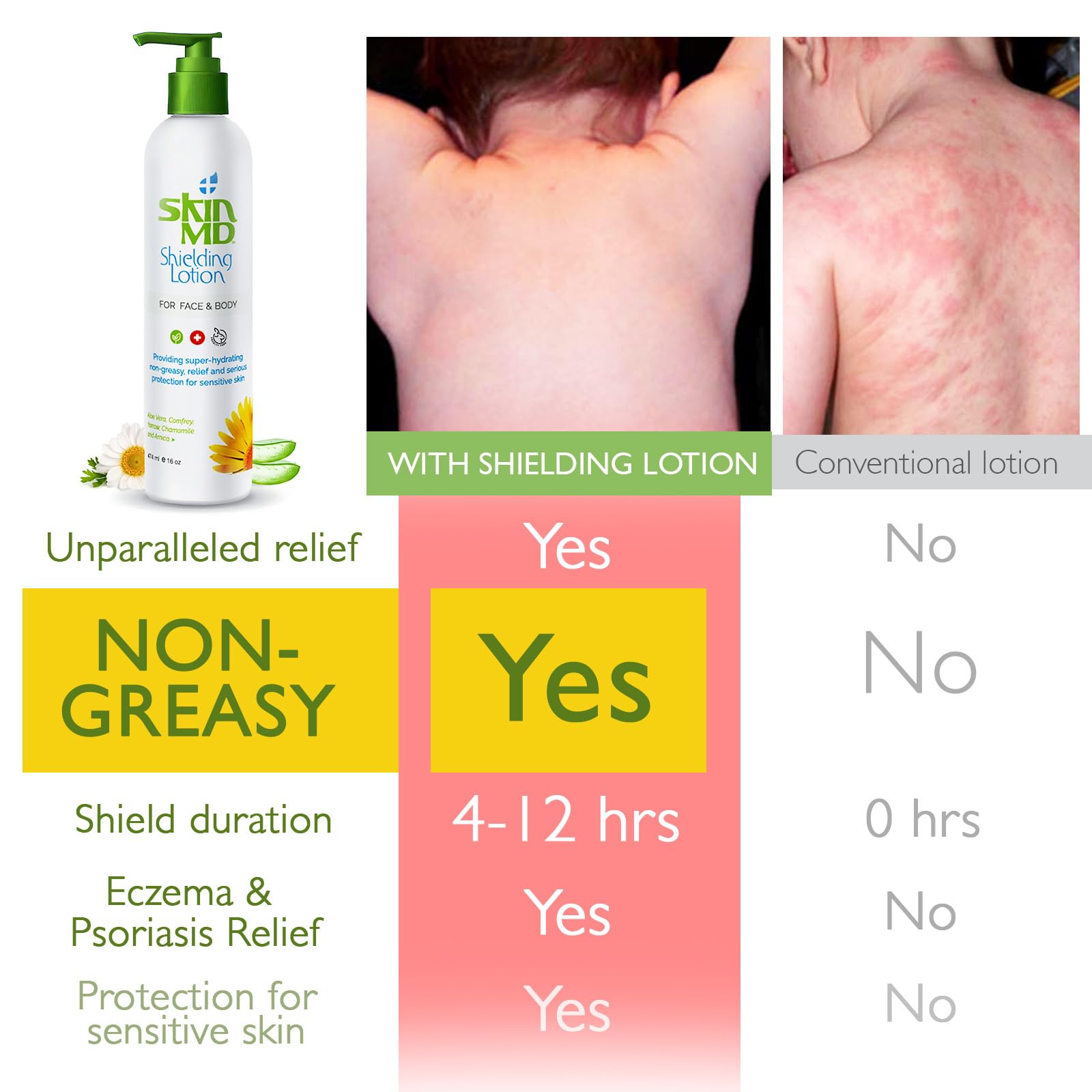 Texture légère et application rapide de Skin MD Shielding Lotion