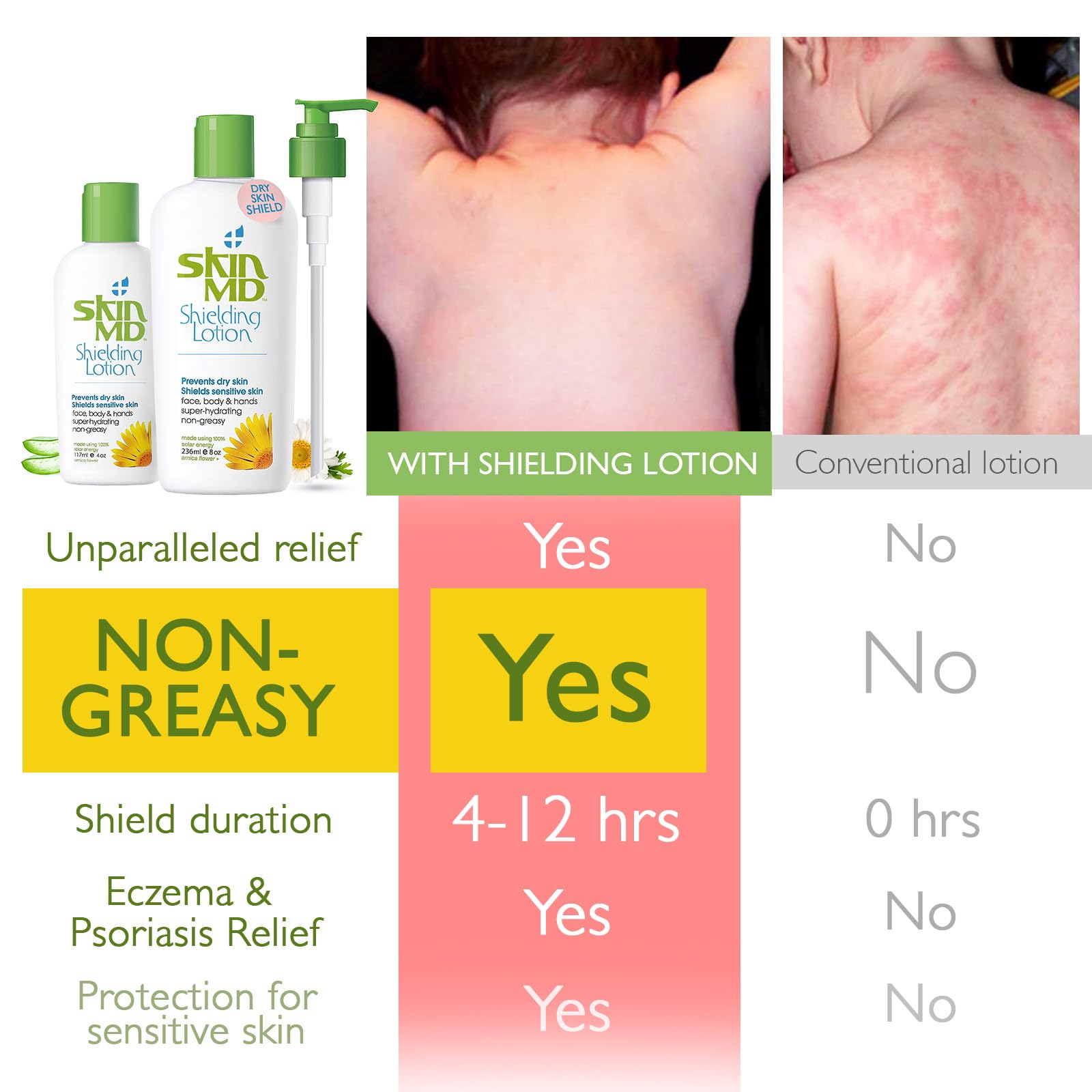 Skin MD Shielding Lotion bouteille 4oz Dispenser, application pratique pour déshydratation ciblée.