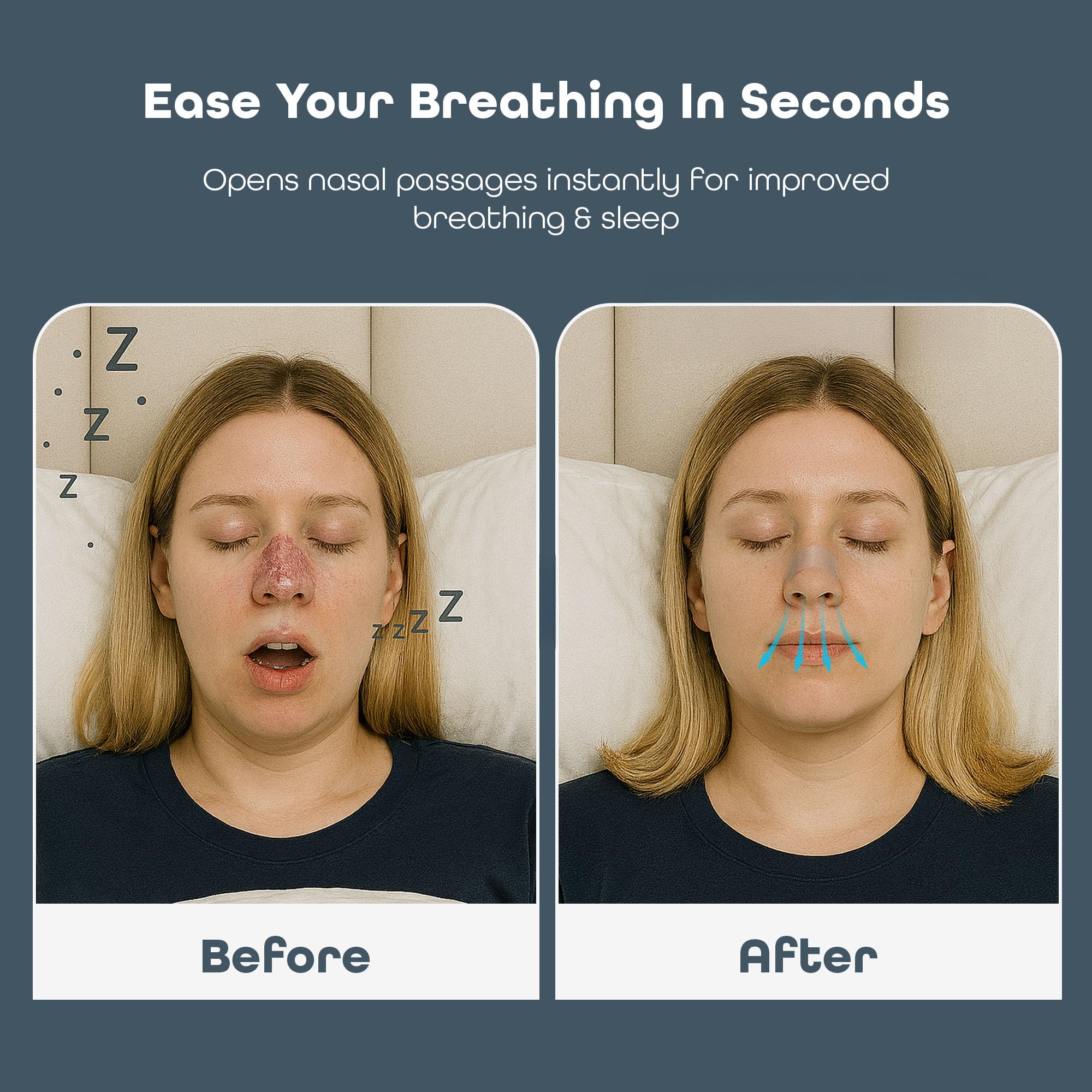 Sleep Habits Bandes Nasales voyage: utilisation pratique lors des déplacements.