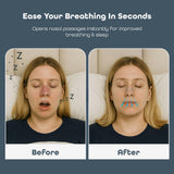 Sleep Habits Bandes Nasales voyage: utilisation pratique lors des déplacements.