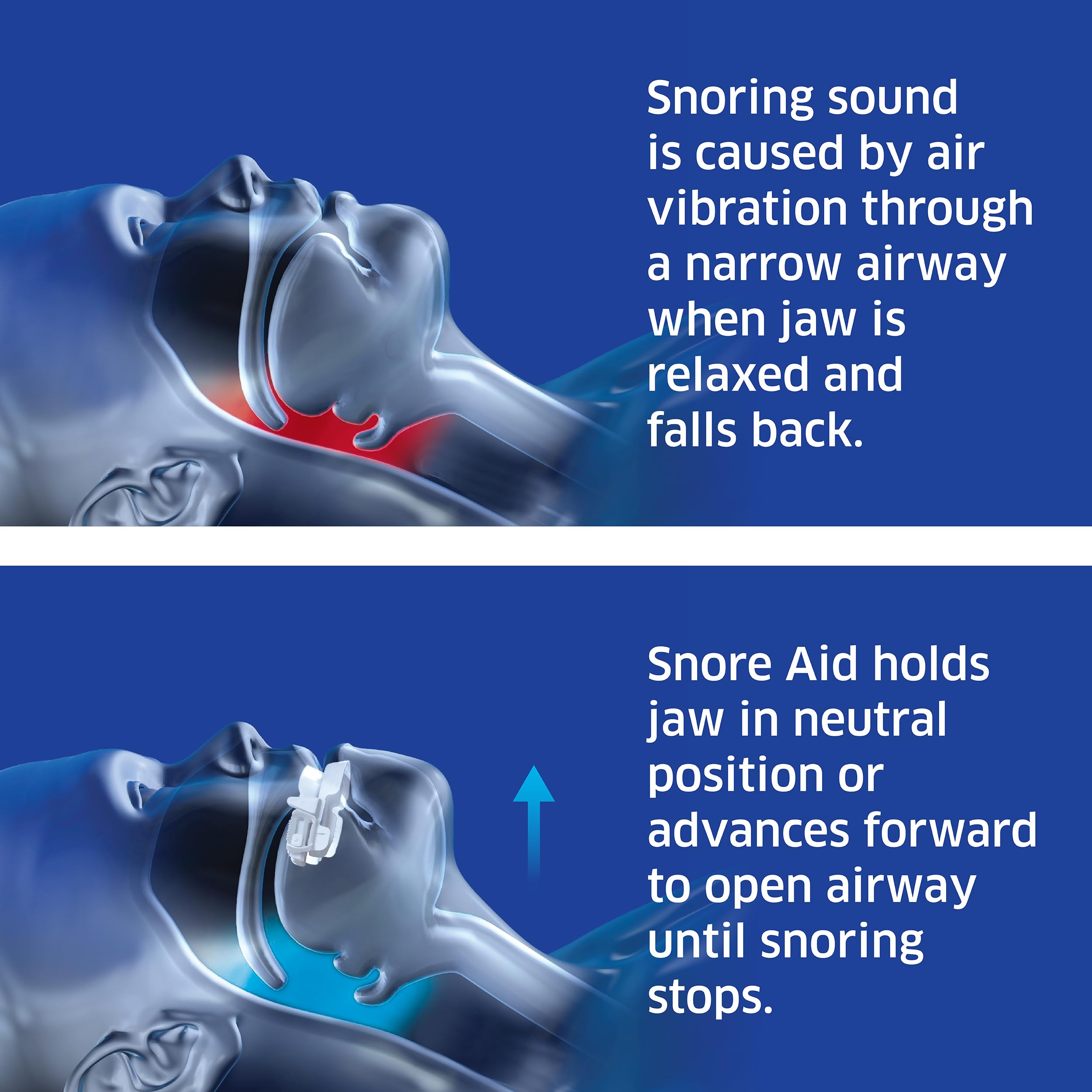 SleepRight Snore Aid, adaptation des arcades pour toutes les tailles.