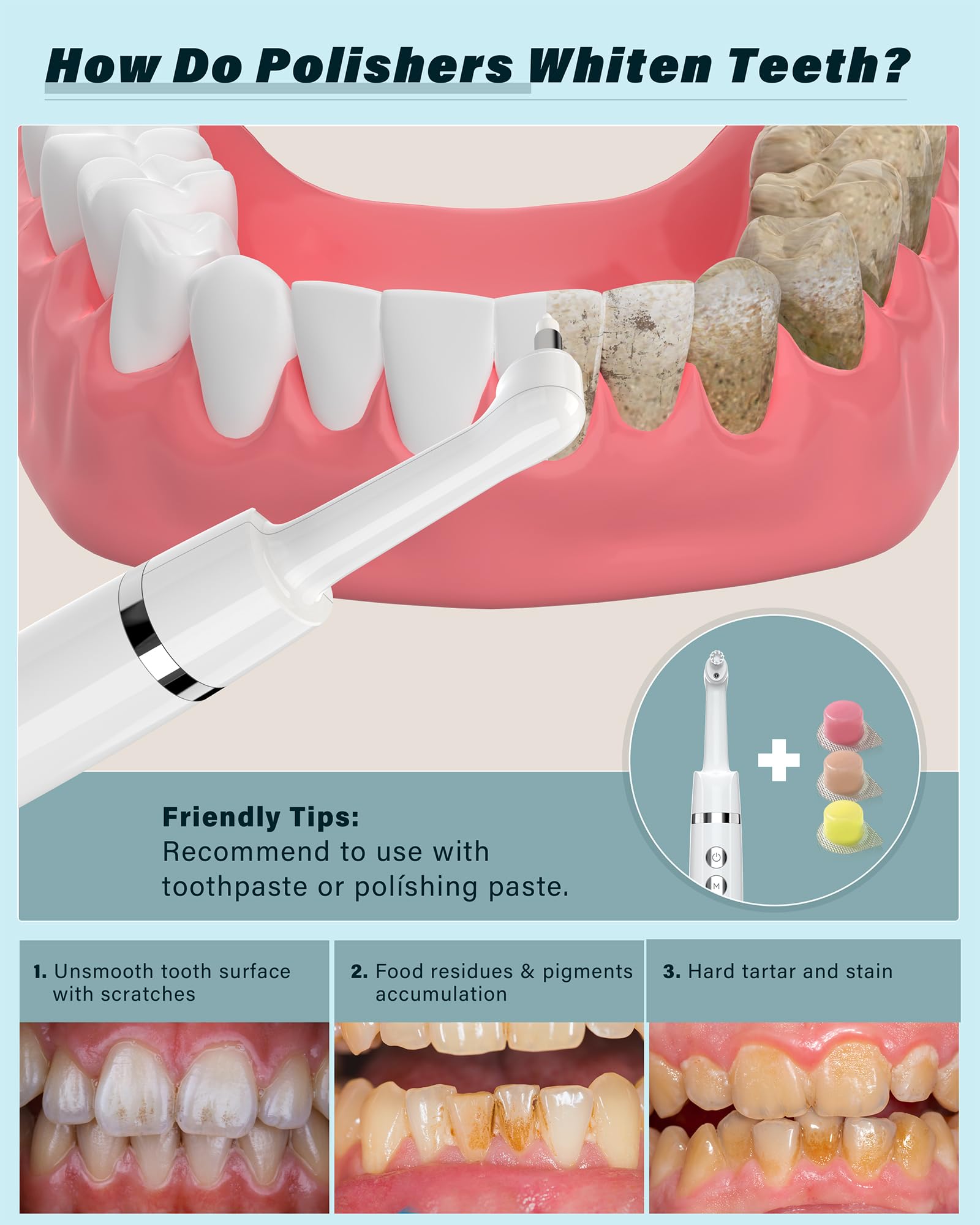 Smile-Aid kit soin dentaire maison pour une routine complète et économique