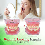 SmileFix Kit : application rapide à domicile pour dents endommagées.