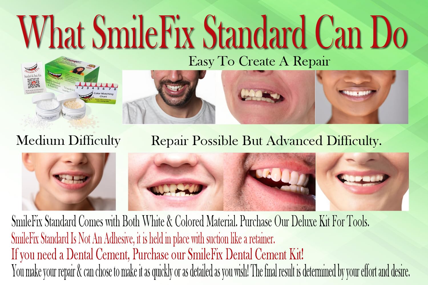SmileFix Kit : composants durables pour réparations dentaires temporaires.