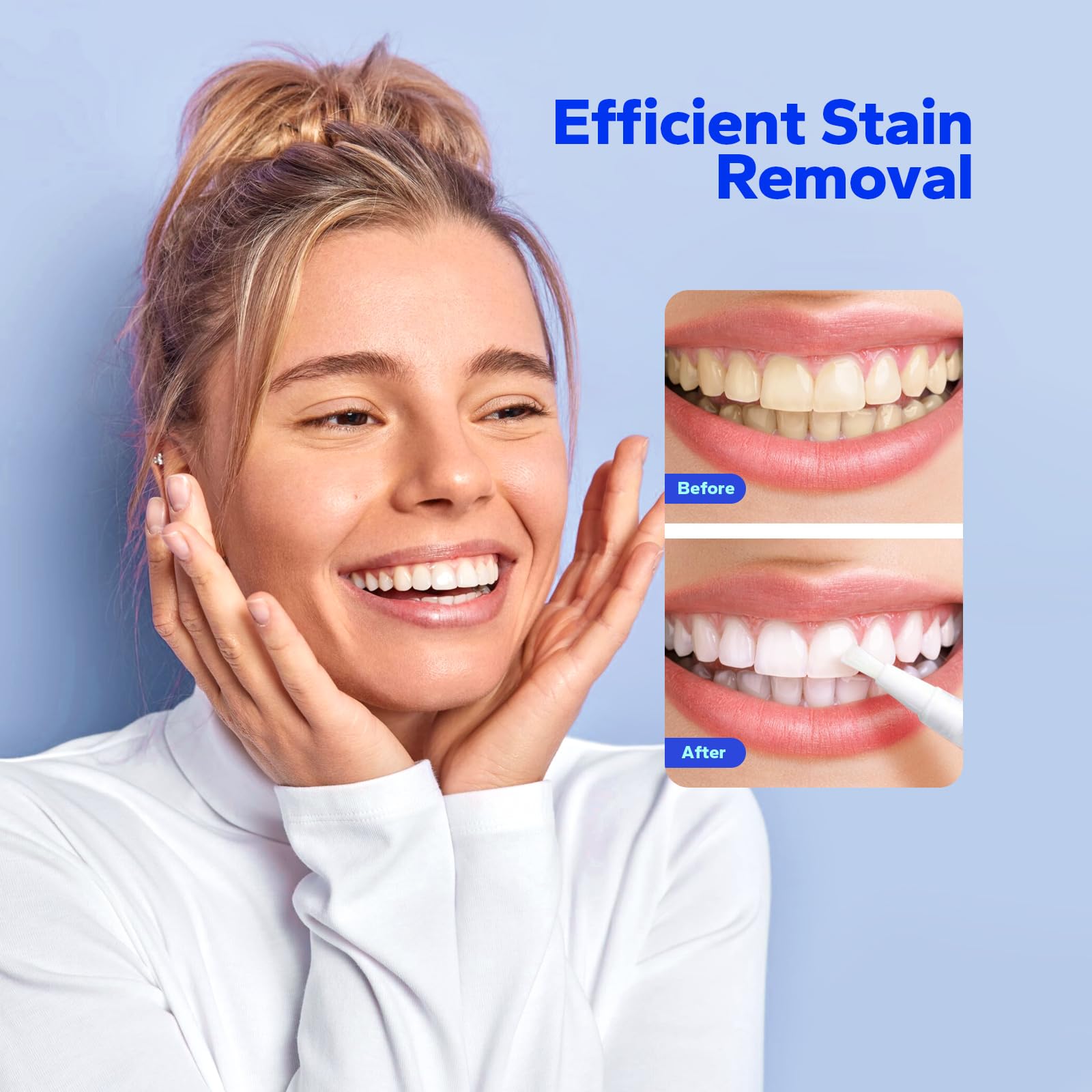 SmileShark applicateur précision stylo, application propre et ciblée.