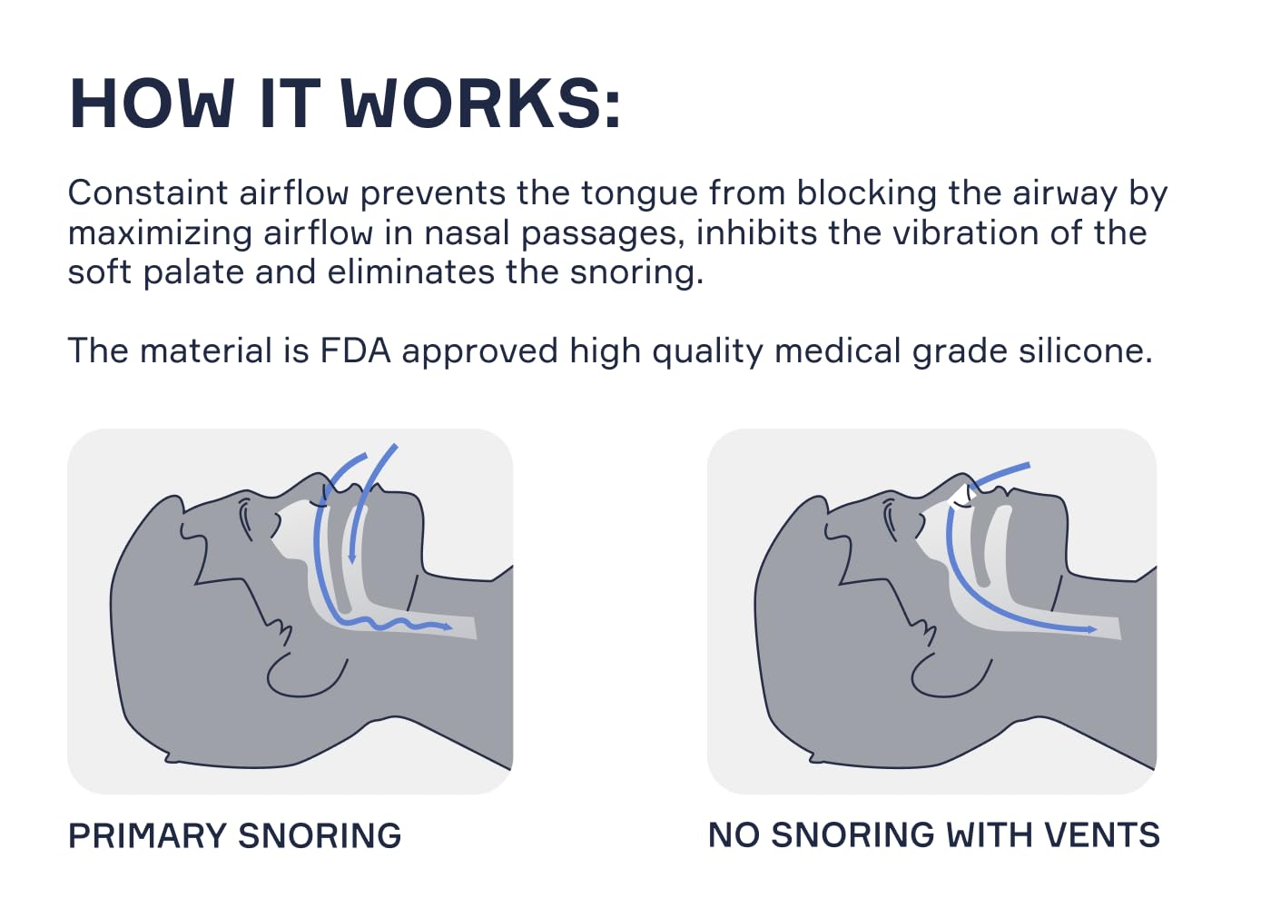 Snore Bastion – accessoire nasal pour nuits plus paisibles et moins de ronflement.