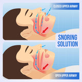 SnoreGuard lavage quotidien : nettoyage facile après chaque utilisation.