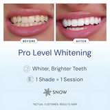 Snow embout bouche led blanchiment: embout confortable pour un usage propre et précis.