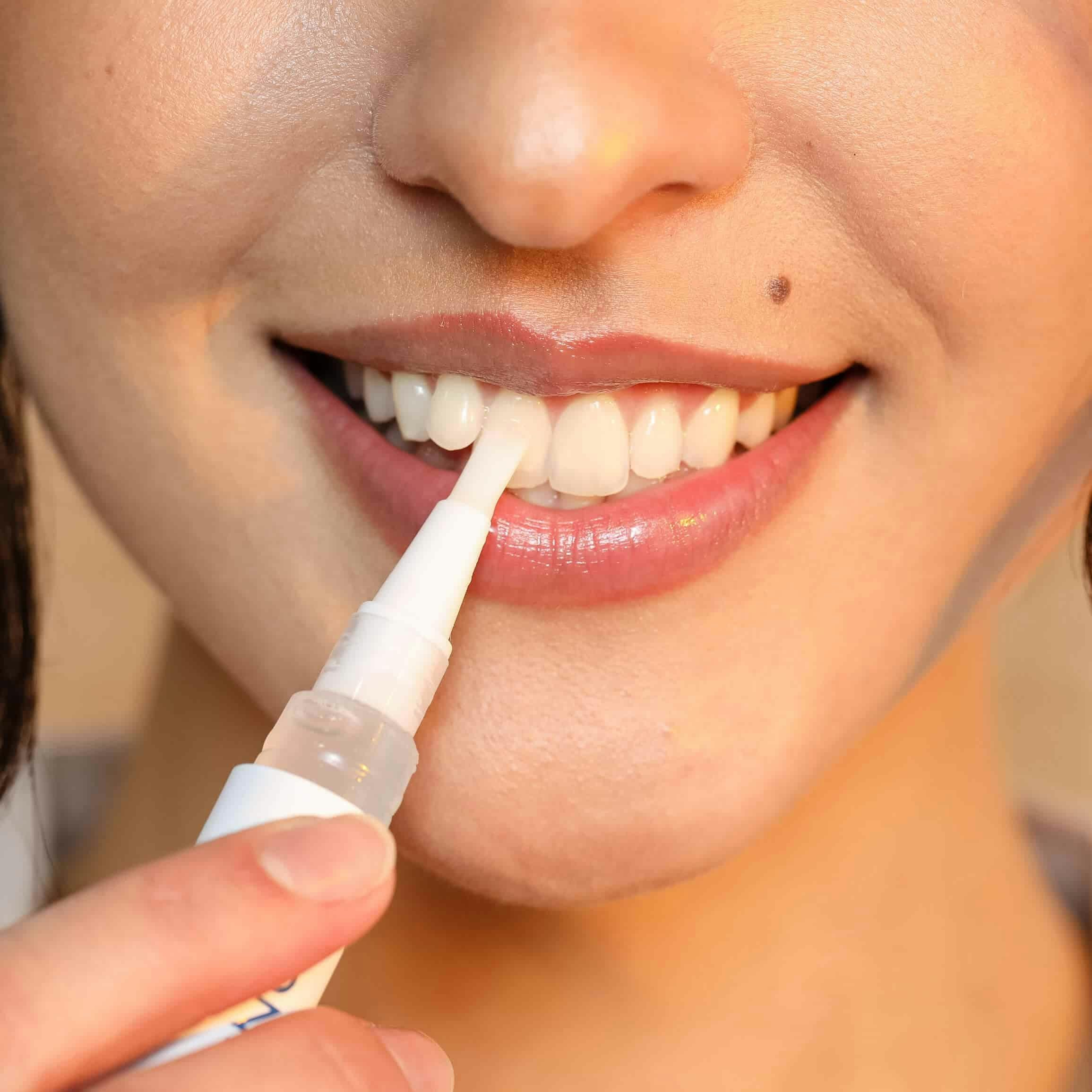 SNOW guide de teinte pour suivre l’évolution de vos dents.
