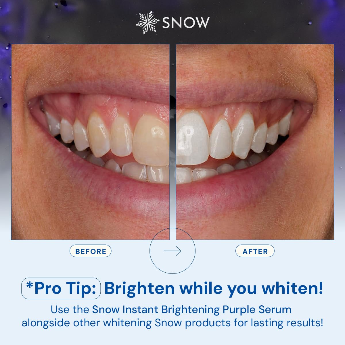 SNOW – format voyage idéal pour conserver une routine sourire en déplacement.