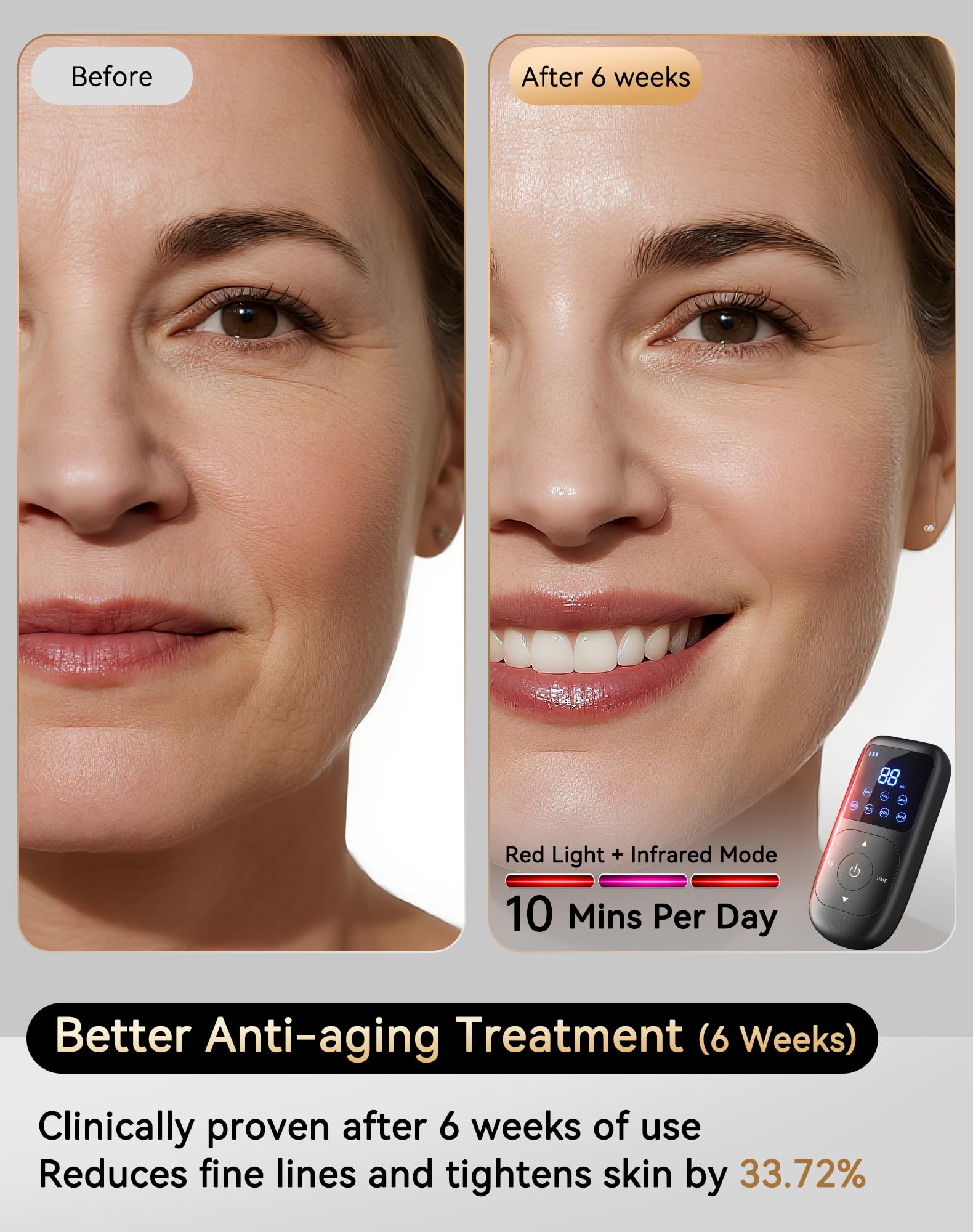 Sobetuar iQLED énergie 5x, puissance pour photothérapie faciale.