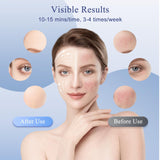 Masque somlzu thérapie LED du visage pour le bien-être