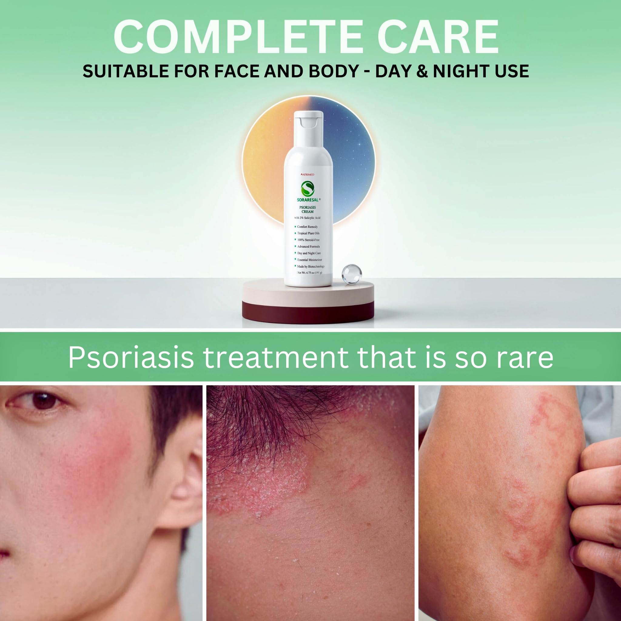 SORARESAL 2% acide salicylique – soin ciblé pour lisser les plaques