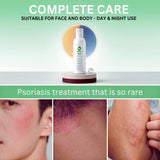 SORARESAL 2% acide salicylique – soin ciblé pour lisser les plaques