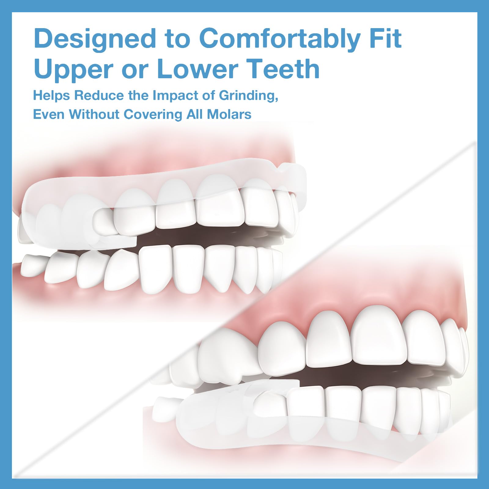Garde-dents SPEQUIX taille universelle adaptée à la plupart des adultes.