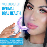 Starlite Smile Gum Light lumière bleue prête au blanchiment avec gels compatibles