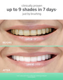 Supersmile Extra White – dose dentifrice pratique pour une utilisation contrôlée.