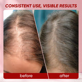 Composition biotine et vitamines soutenant les cheveux