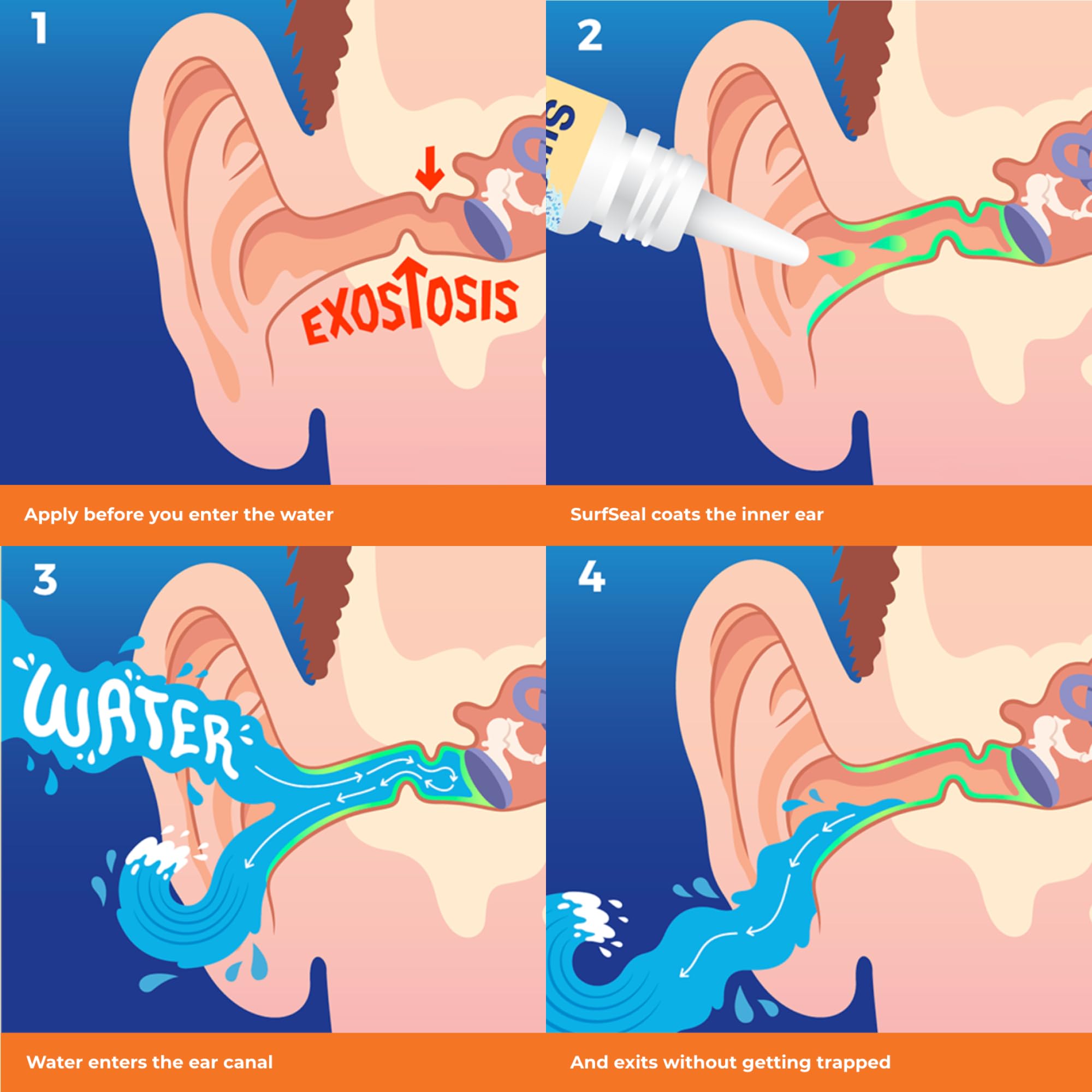 Gouttes SwimSeal avant la nage pour préparation des oreilles