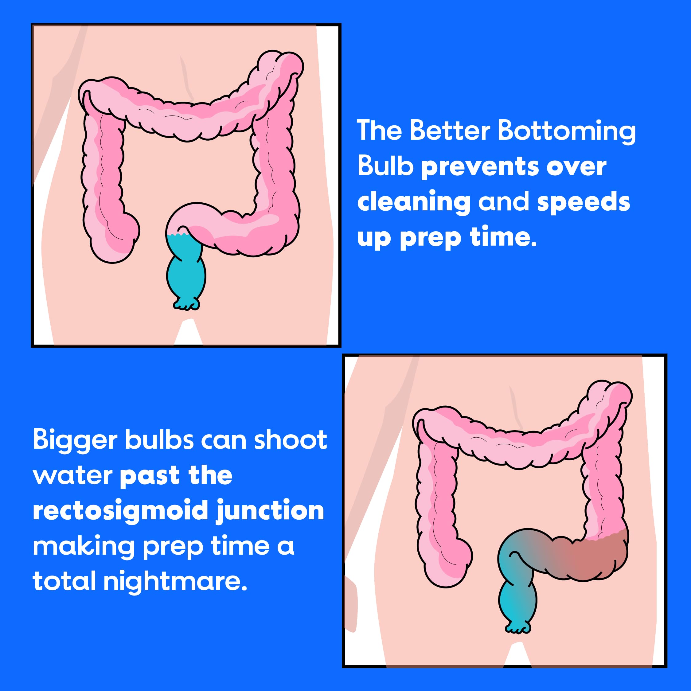 The Bottom's Digest bulbe douches facile à nettoyer, design discret et pratique.