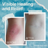 The Ocean Healed My Eczema – Formule vegan et sans OGM adaptée à tous.